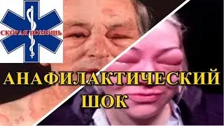 Анафилактический шок / Симптомы / Неотложная помощь