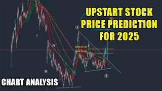 Upstart Stock Price Forecast Short-Term And Long-Term For 2025! Already Made $$$ With It!