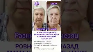 СУПЕР-ОМОЛАЖИВАЮЩИЙ ПОРОШОК #колаген #морскойколаген #суставы #мешкиподглазами #сибирскоездоровье