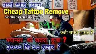 Cheap Tattoo Remove || Kathmandu Nepal || Best Tattoo remove center