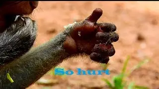 million sad !!! Julina deeply worry about injure, She look so unbelievable, Very pity baby 1087