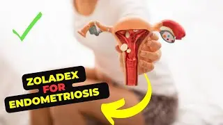 Everything You Need to Know About Zoladex Injections: A Comprehensive Guide