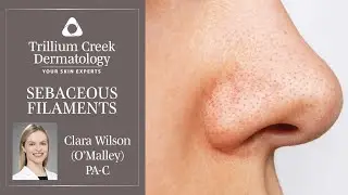 What are Sebaceous Filaments?