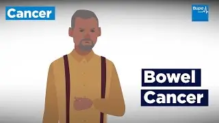 Bowel cancer screening: things to know | Bupa Health