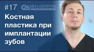 Что такое костная пластика? Наращивание костной ткани при имплантации зубов