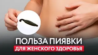 В чем польза гирудотерапии | Показания к лечению пиявками | Гирудотерапия в гинекологии