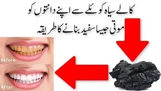 Coal  Teeth Whitening دانتوں کو چمکانے کا انوکھا طریقہ Unbelievable Trick To Clean Your Teeth
