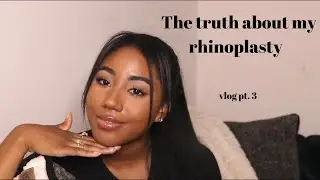 EVERYTHING ABOUT MY ETHNIC RHINOPLASTY | DR. YUSUF ORHAN pt. 3