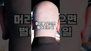입자가속기에 머리를 넣으면 벌어지는 일