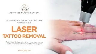 Laser Tattoo Removal at Advanced Plastic Surgery