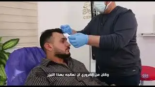ADEENA co2 | Maria Trading®️ | House of Aesthetics