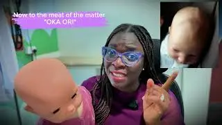 Oka Ori: Stop Doing This to Your Baby’s Head! (Doctor Explains the Soft Spot) | Your Baby's Doctor 