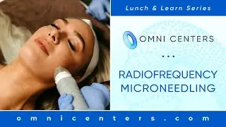 Radiofrequency Microneedling