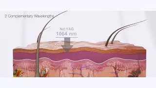 Láseres Fotona - Er:YAG y Nd:YAG en Dermato-estética con SP Dynamis