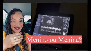 Fui realizar uma Ultrassom para tirarmos Dúvida sobre o sexo do nosso bebê