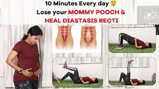 Lose Mommy Pooch and Heal Diastasis recti #rosifit #diastasisrectiexercises #diastasisrecti