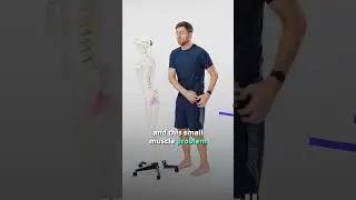 Piriformis Syndrome & Sciatica