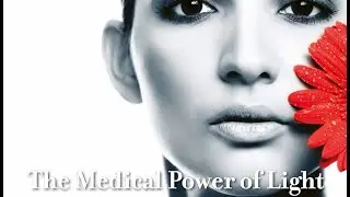 Fotona 4D facelift training video