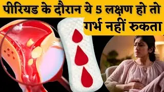 पीरियड में ये 5 लक्षण हो तो गर्भ नहीं रुकता - Periods care & fertility tips #prernasfertilitycare