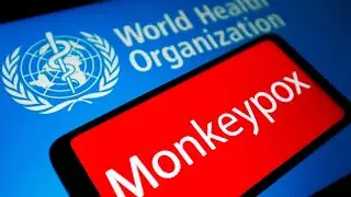 Mpox Outbreak 2024 What You Need to Know