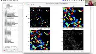 JUMP Cell Painting CellProfiler analysis pipeline walkthrough