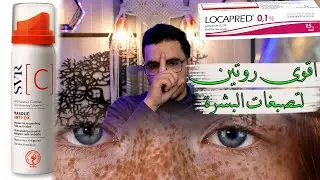 اقوى روتين لتصبغات البشرة| شرح كامل لمنتجات و طرق تفتيح و توحيد لون البشرة من التصبغات