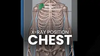 X-ray Positioning Chest