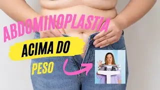 Abdominoplastia acima do peso, pode?