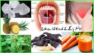 How Remedies For Tonsillitis |  Home Remedies for Tonsillitis | Tonsil ka ilaj  kaise kare( part 3)
