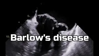 Barlow's disease