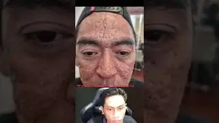 YUK YG MAU BEROBAT LANGSUNG AJA @riabeauty.idmalang 
