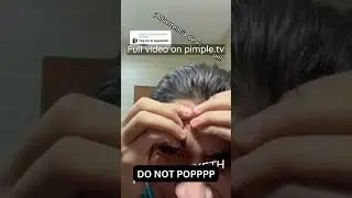 DO NOT POPPPP