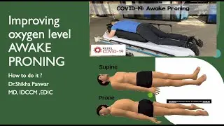How to improve oxygen levels in COVIA 19 without oxygen and how to do AWAKE PRONING