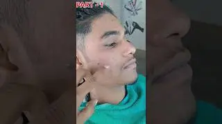 How to Remove Face Black Head 