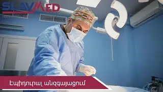 Էպիդուրալ անզգայացում