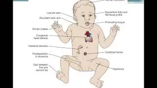 Chapter 6 Genetic and Developmental Disorders BIOL300