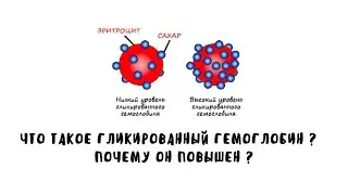 Гликированный гемоглобин - что это такое ? Что означают результаты ? Поймет каждый.