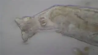 Rotaria citrina, pregnant with twins