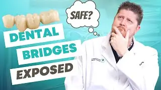 5 Things You Didn't Know About Dental Bridges (but should!)