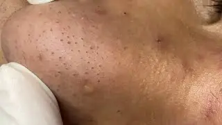 Satisfying Relaxing #ThuyTruong460