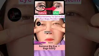 02 Movements To Solve Big Eye Bags Problem #eyelift #eyeexercise #yoga #faceyoga #fitness #shorts