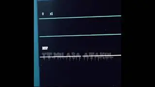 Кадир умер😩💔||Мои братья и сестра💔😭