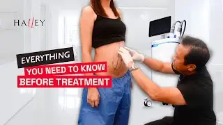 Coolsculpting Elite With Halley Medical Aesthetics: Everything You Need to Know Before YourTreatment