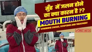 मुँह  में जलन होने का क्या कारन है ?? Mouth Burning 🥵 Syndrome causes, symptoms and treatment.