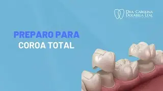 Demonstração de preparo para coroa total