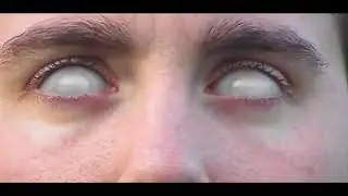 White eyes visual effect example