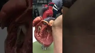 DOOLEY NOTED  Heart Surface Anatomy