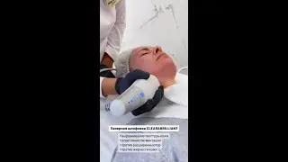 КАК ВЫРОВНЯТЬ ТОН КОЖИ?🔥 #лазернаяшлифовкамосква