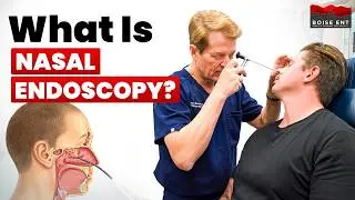 What Happens During a Nasal Endoscopy? ENT Doctor Explains
