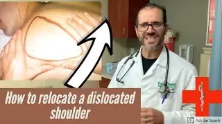 how to put a shoulder back, dislocated shoulder treatment
